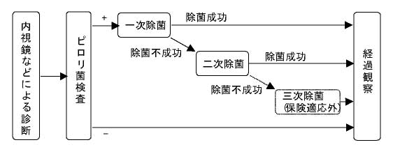 胃内視鏡検査について