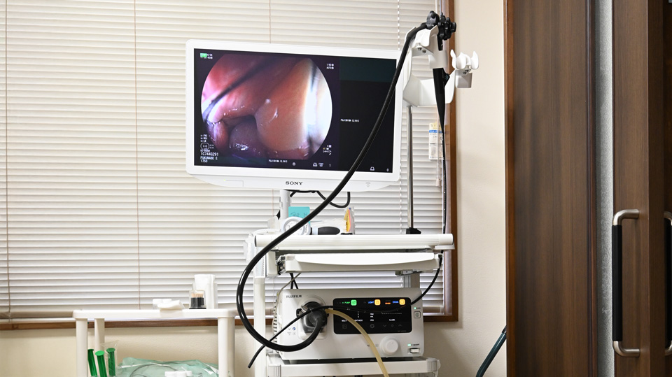 大腸内視鏡検査