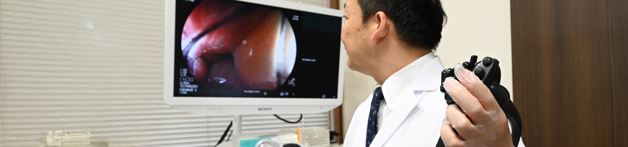 内視鏡検査
