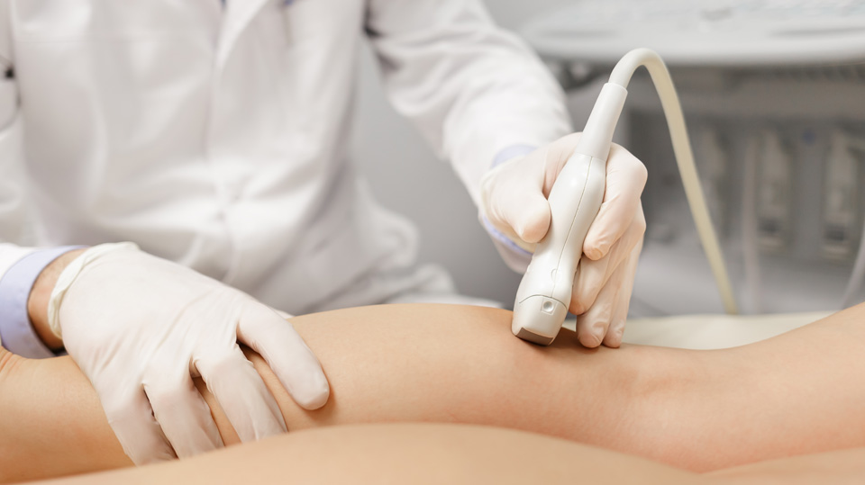 下肢静脈超音波検査（下肢静脈エコー）