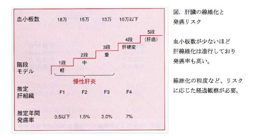 胃内視鏡検査について