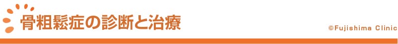 骨粗鬆症の診断と治療