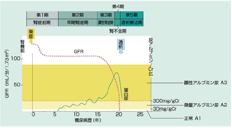 糖尿病性腎症病気分類