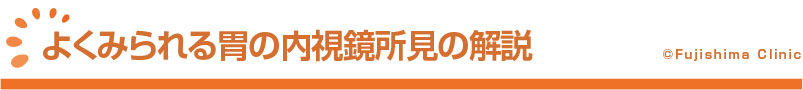 よくみられる胃の内視鏡所見の解説