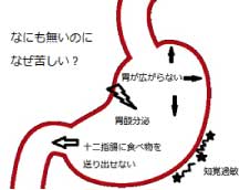 胃内視鏡検査について