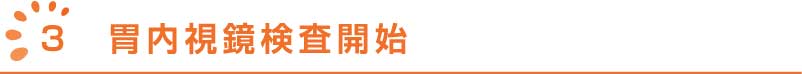 大腸内視鏡検査について